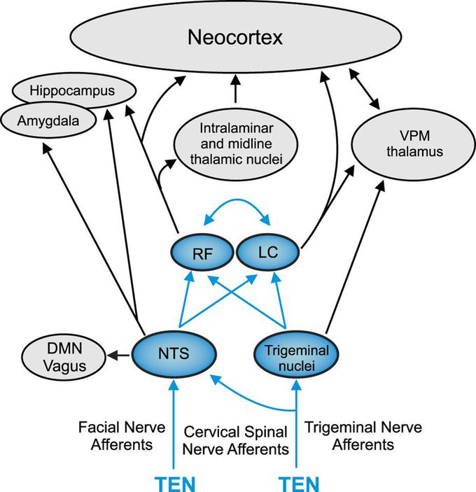 What is neocrtex