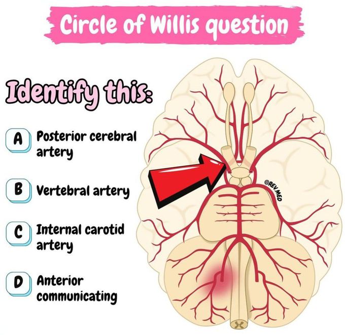 Circle of Willis