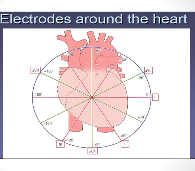 Electrodes around the Heart