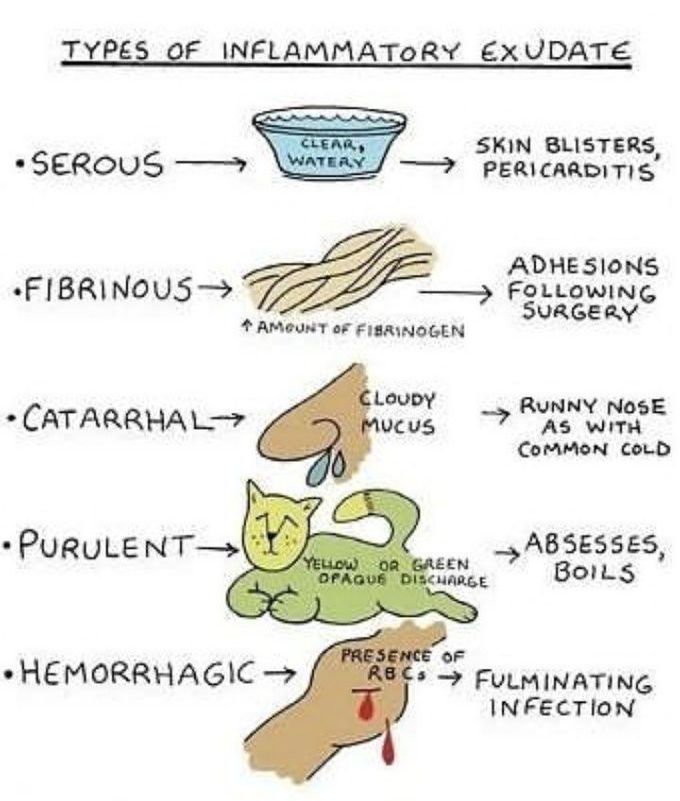 Types Of Inflammatory Exudate