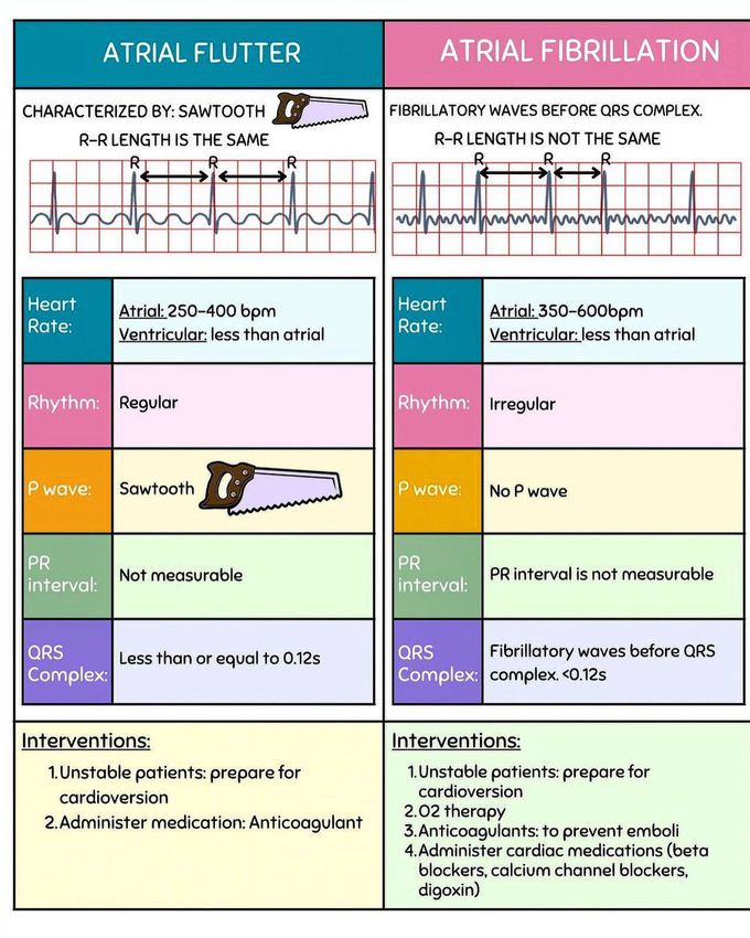 Atrial flutter VS fibrillation