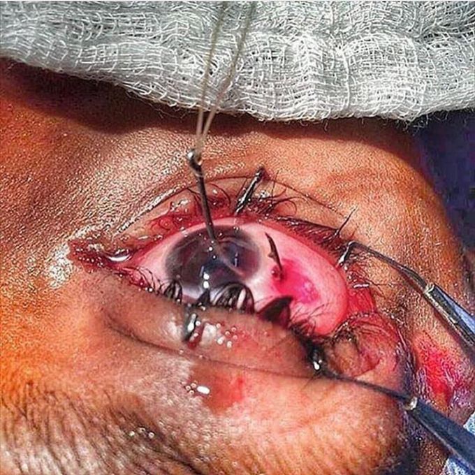 Fishing hook 👁 !!