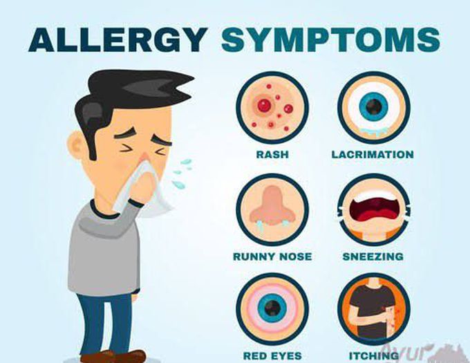 Symptoms of allergy.