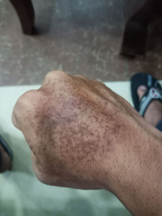 What diagnosis please  tell me?