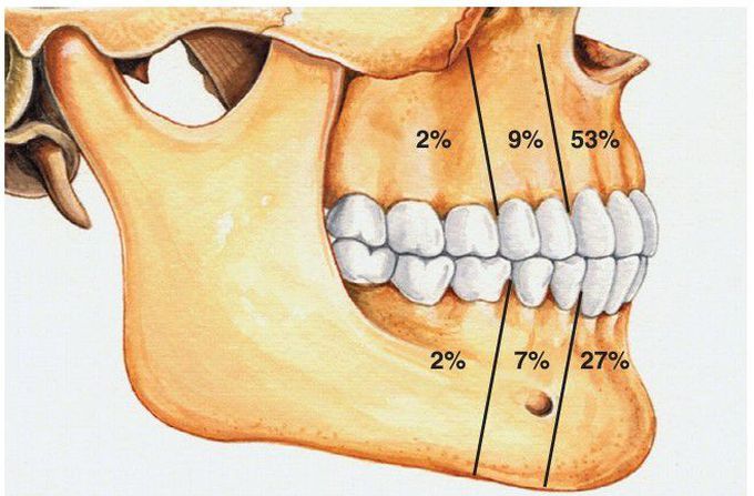 Adenomatoid Odontogenic Tumor distribution