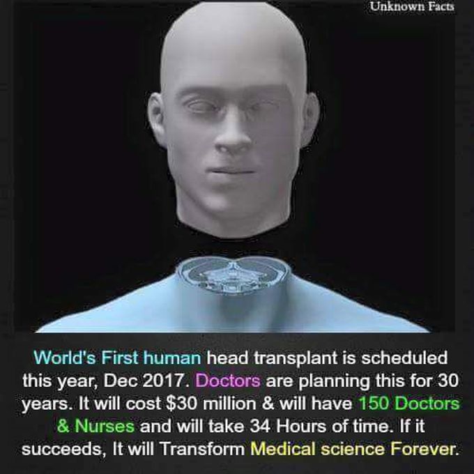 Head Transplantation surgery