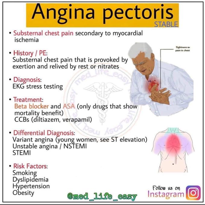 Angina pectoris