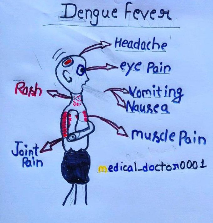 symptoms of dengue fever