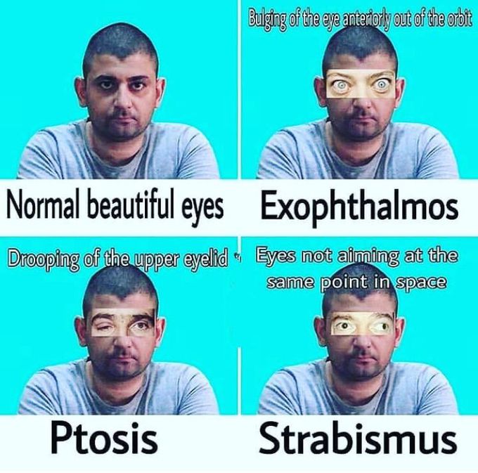 Medstudent’s thoughts 💭 all the time 😂😎