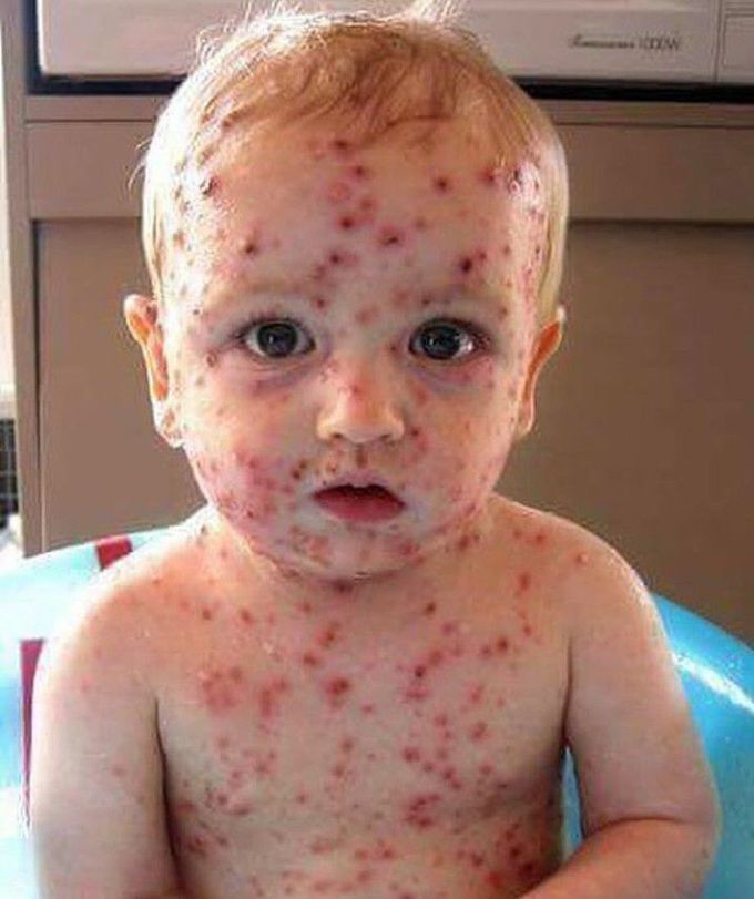Diagnosis?