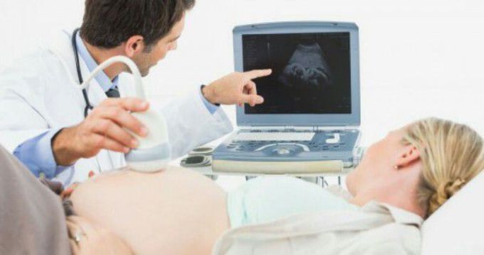 USG (ULTRASONOGRAPHY)