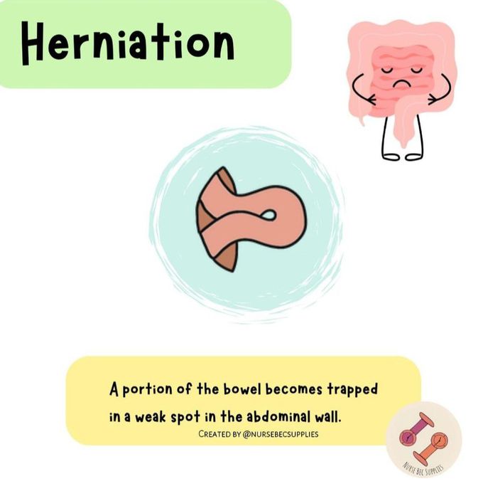 Herniation