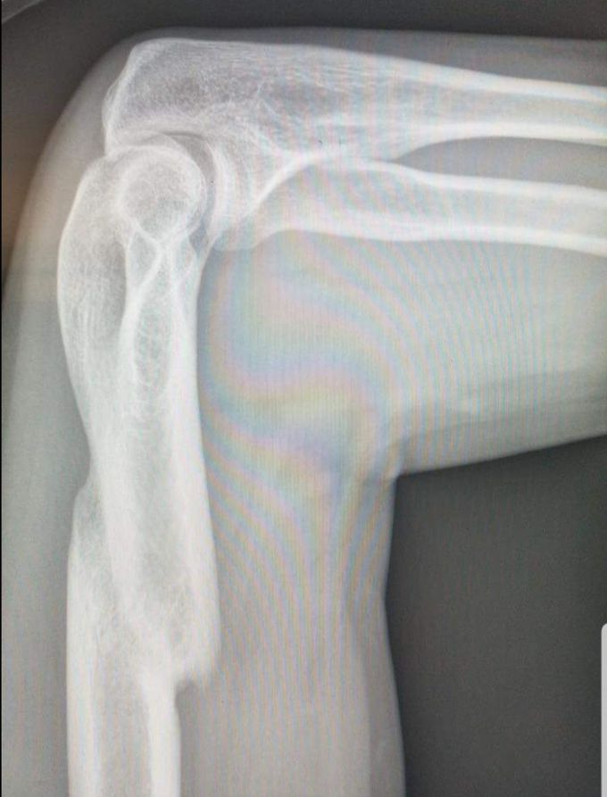 Diagnosis and recommended treatment?