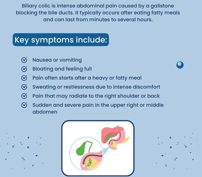 Biliary Colic