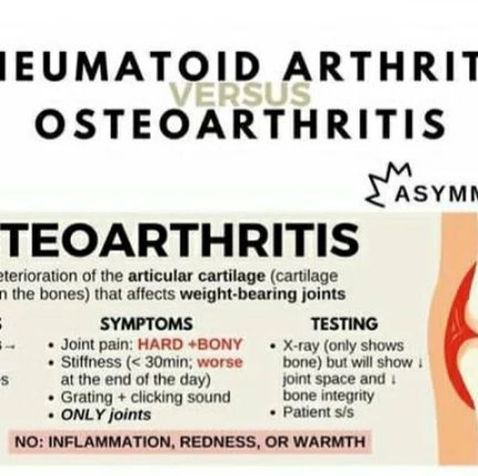 Artheoarthritis