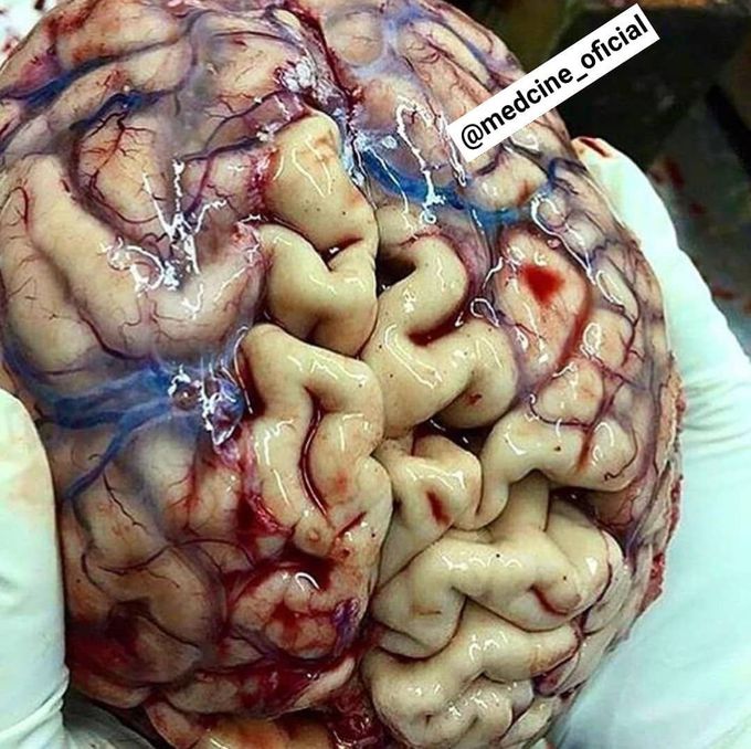 Our brain is beautiful!