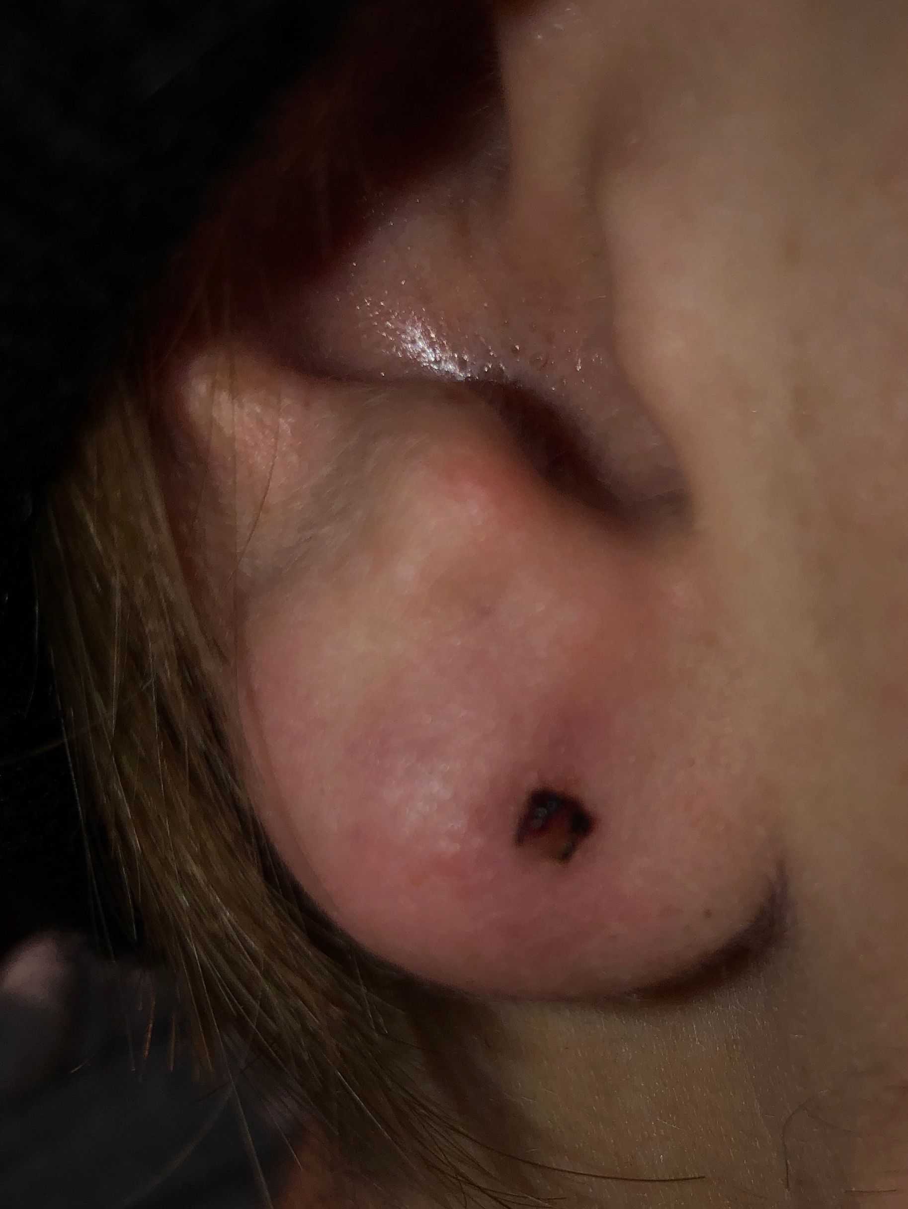 Infected ear lobe sale piercing in child