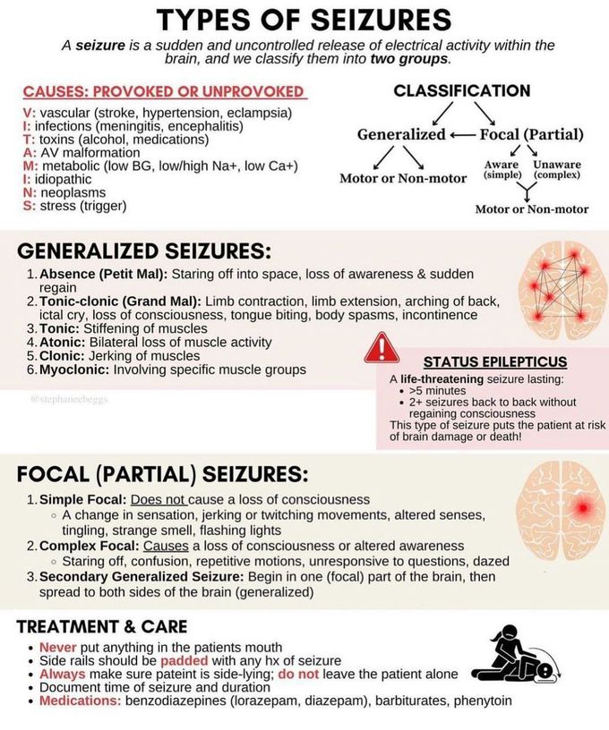 Types of Seizures