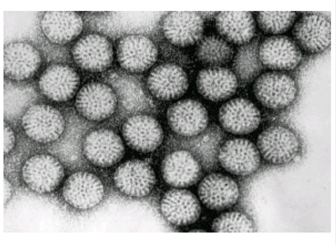 Identify the virus in the picture # Microbiology