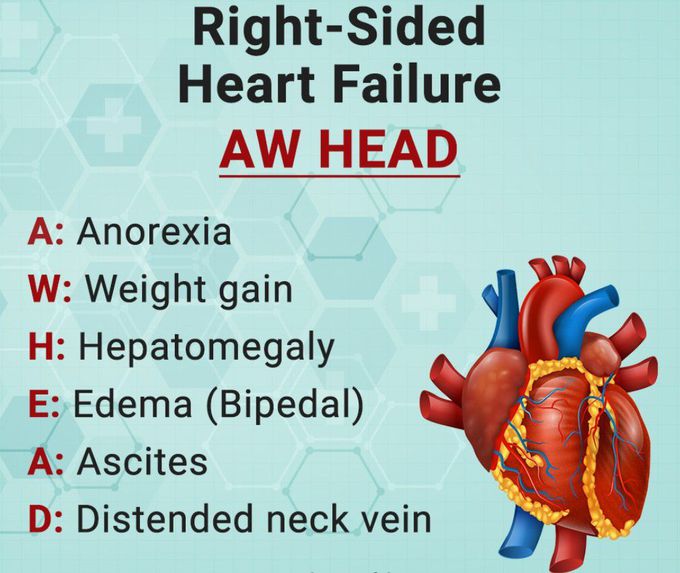 Right Sided Heart Failure