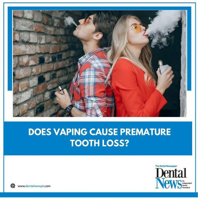 Vaping and Premature Tooth Loss!