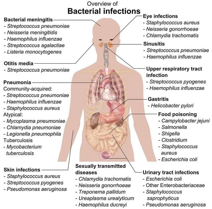 Bacterial infections- overview