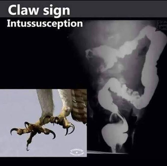 Claw sign
