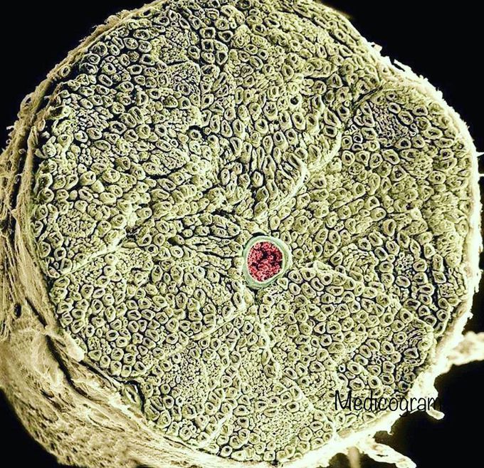Incredible coloured scanning electron micrograph (SEM) of - MEDizzy