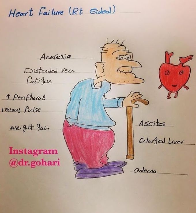Heart failure