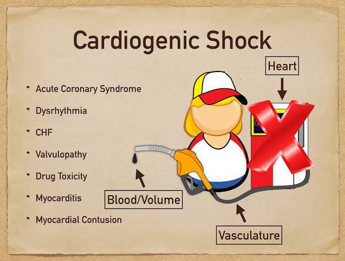Symptoms of cardiogenic shock