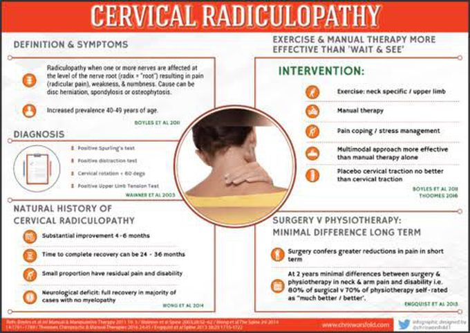 Cervical Radiculopathy