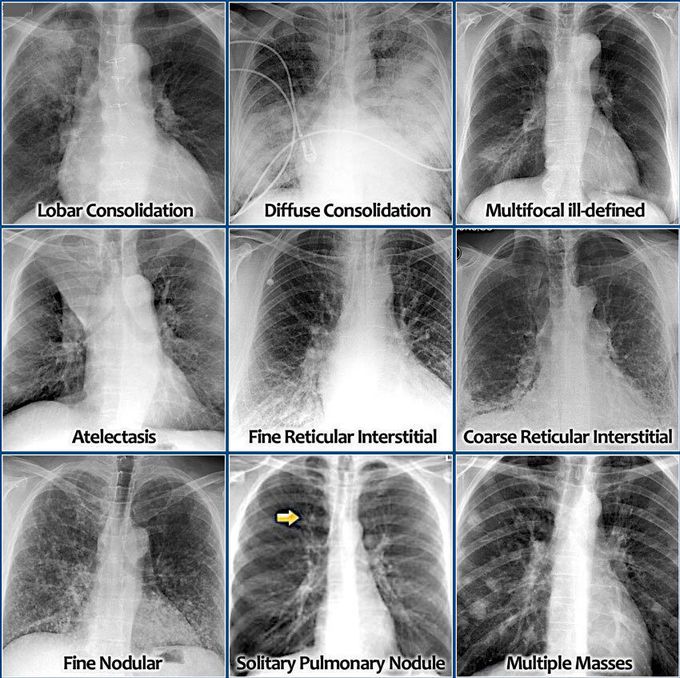 Imp xrays