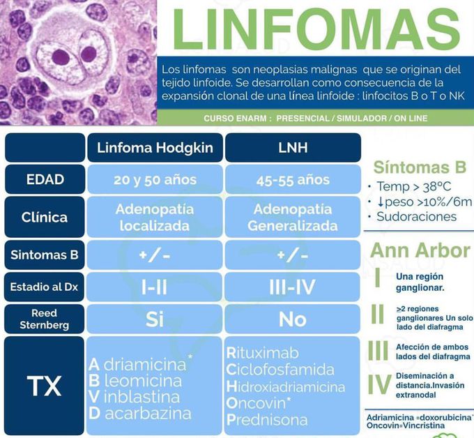 Linfomas