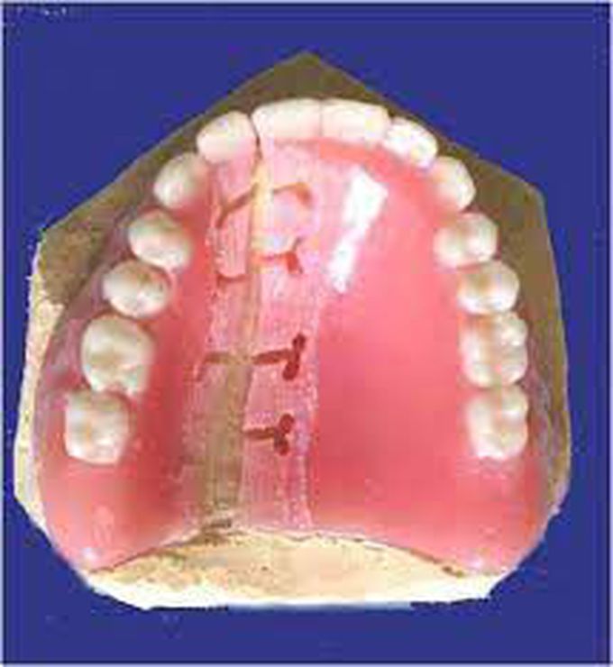 Procedure of rebasing - MEDizzy