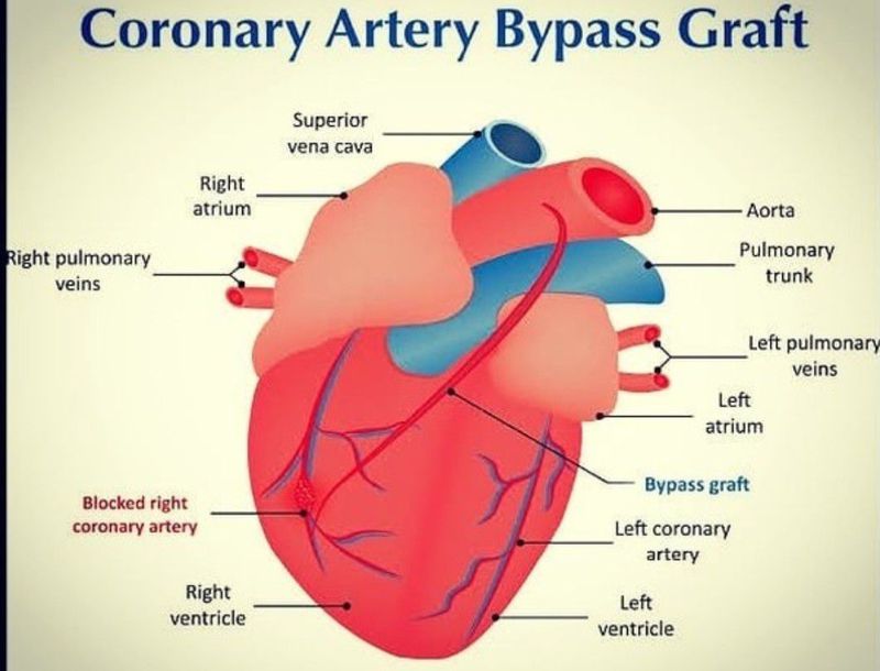 Heart - MEDizzy