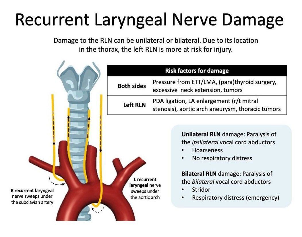 Recurrent Laryngeal Nerve Damage - MEDizzy