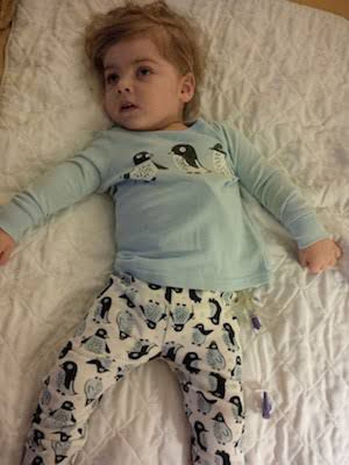 causes of west syndrome