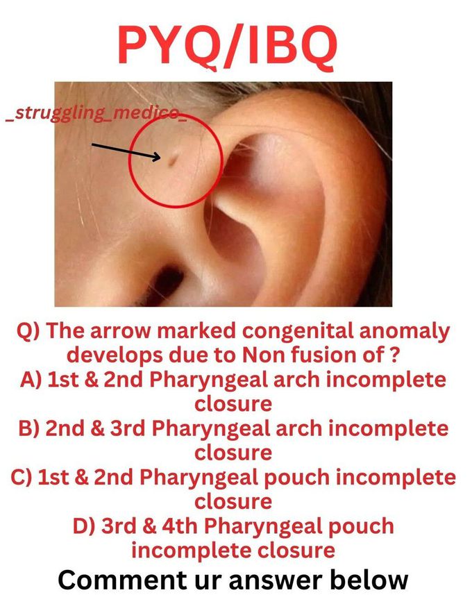 Identify the Structures