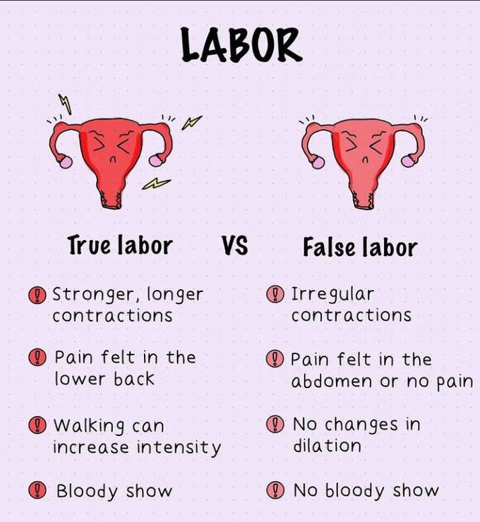 True Labour Vs False Labour Medizzy 