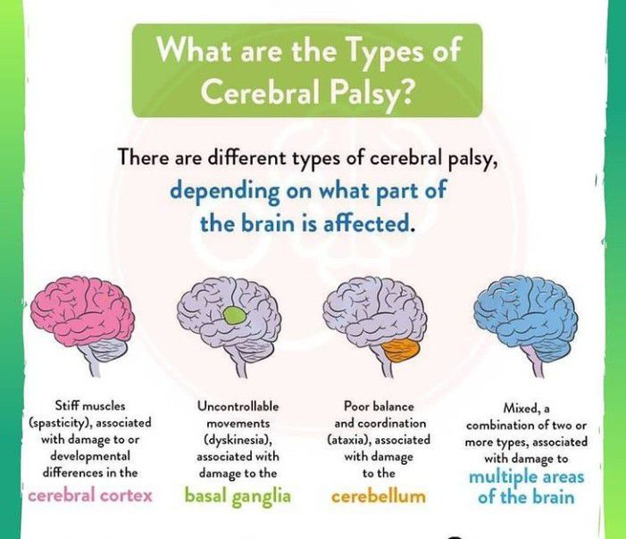 Types of cerebral palsy