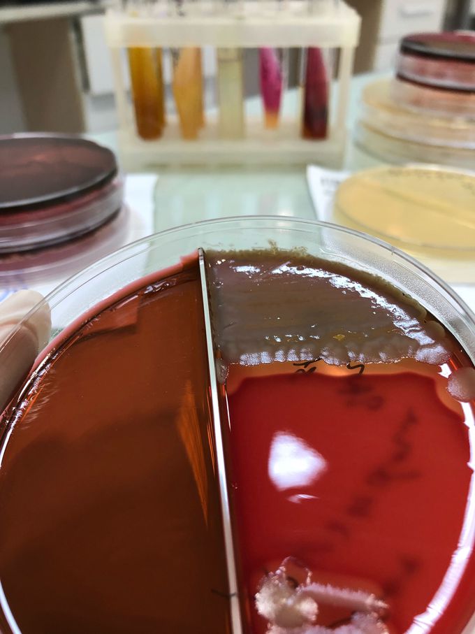 Bacillus cereus