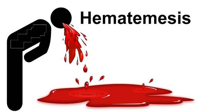 Hematemesis