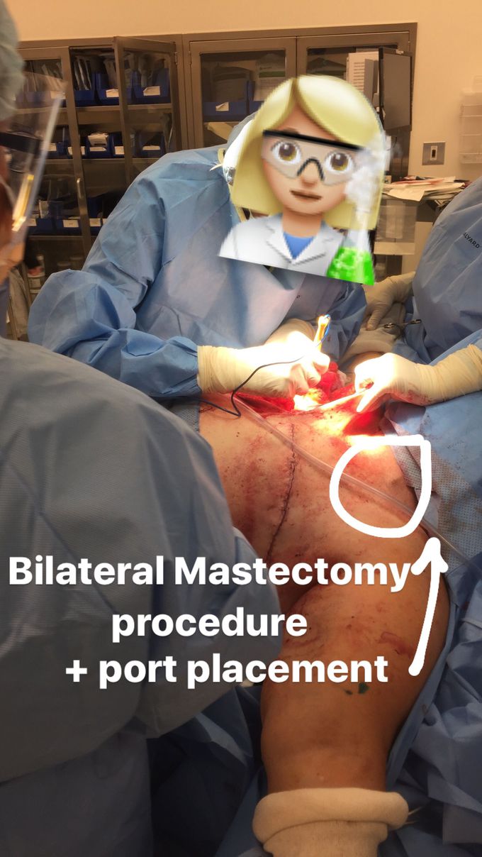 Bilateral mastectomy