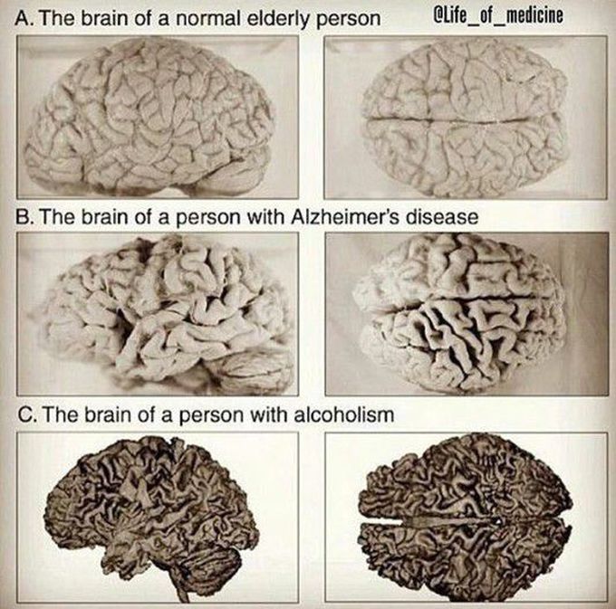 Brains