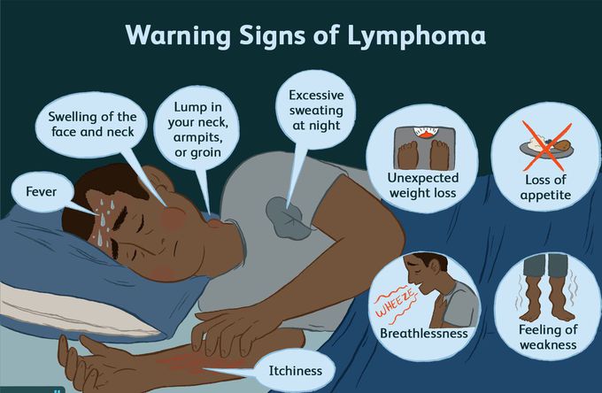 Symptoms of Non-Hodgkin's lymphoma