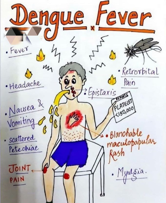 Dengue