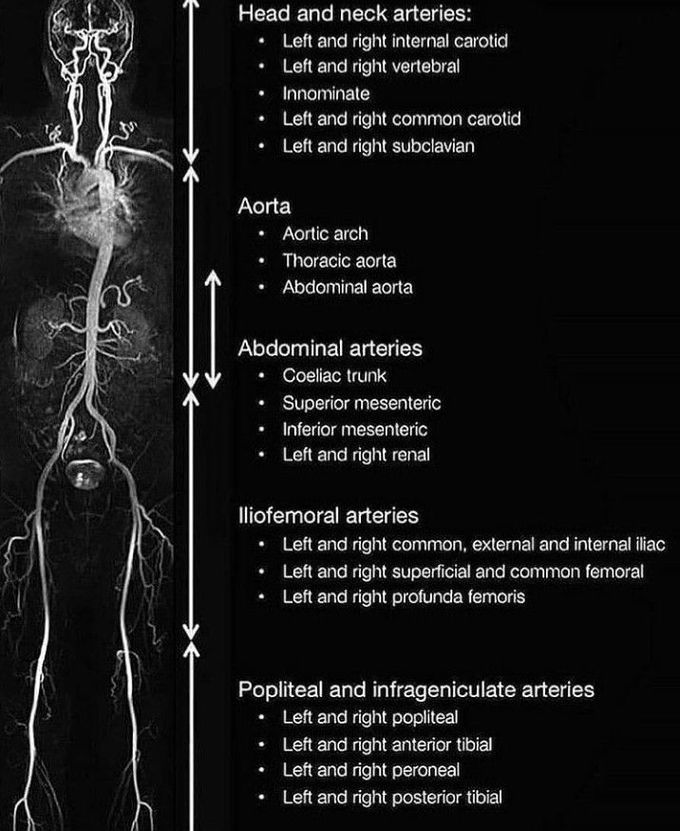 Magnetic resonance angiography (MRA) of the body