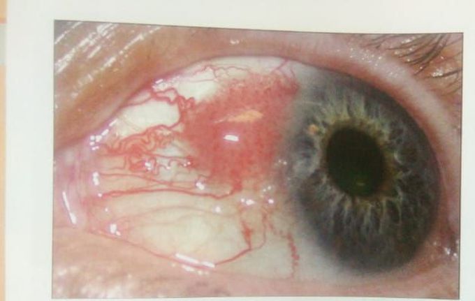 what is your diagnosis？