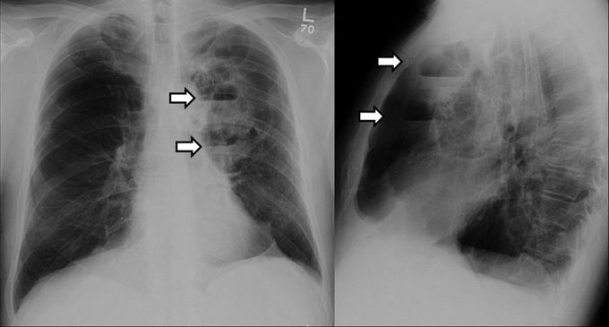 What's your dx??