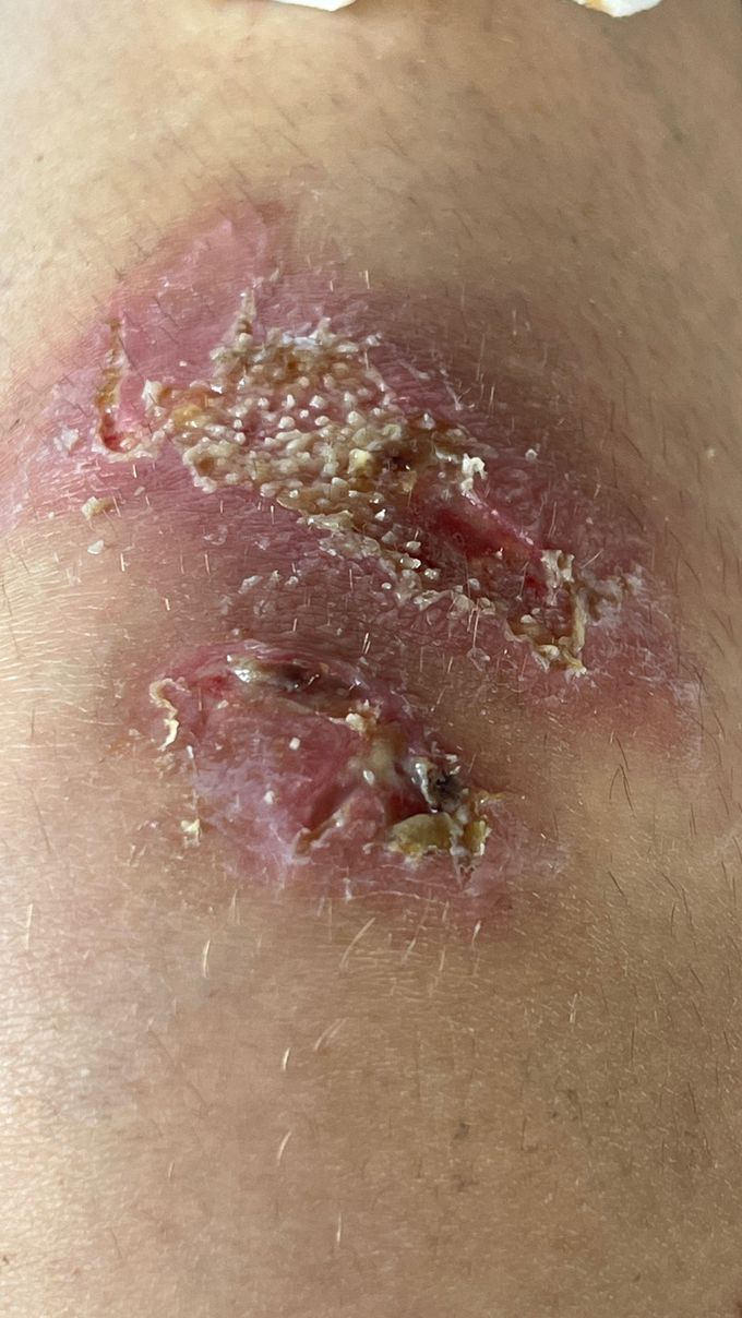 What do the white spots indicate?